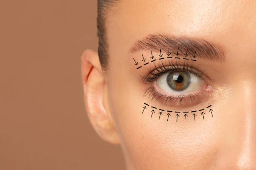 Can Blepharoplasty remove excess upper eyelid skin