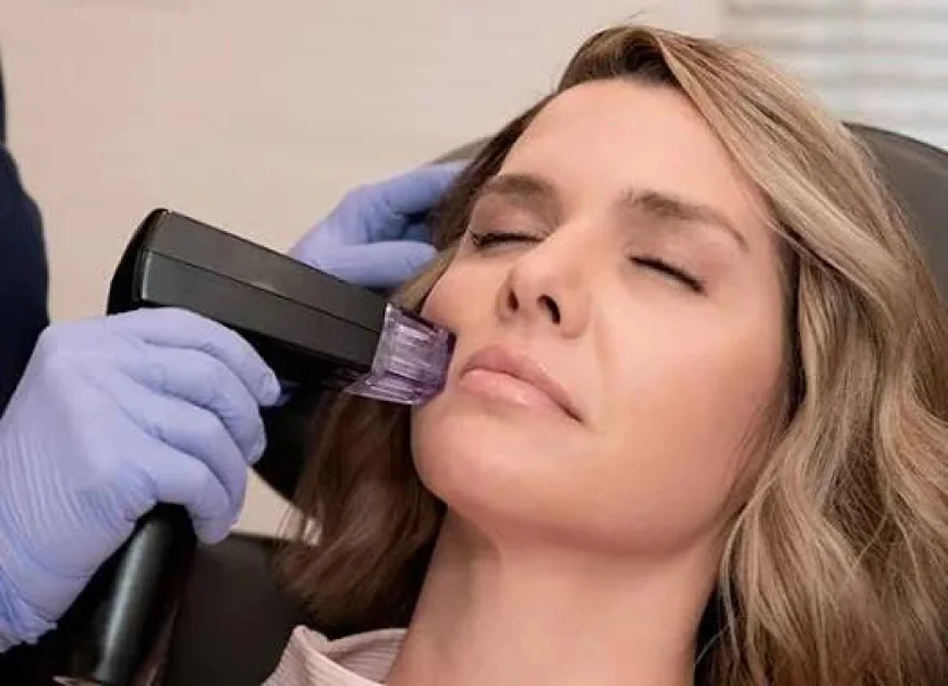 Is Morpheus8 Treatment Good for Acne Scars?