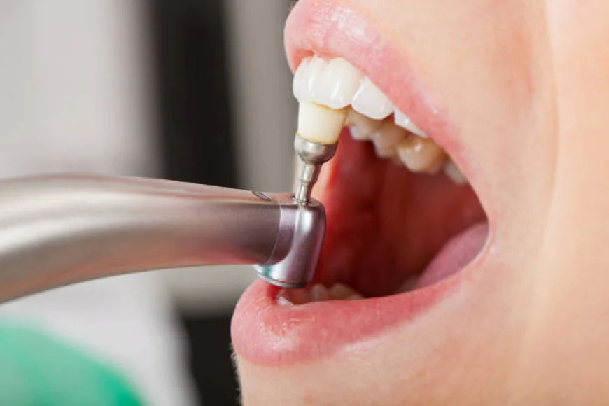 Does Teeth Cleaning help prevent gum disease early