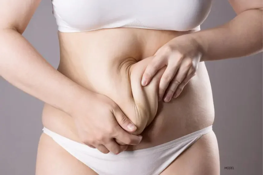 How Long Should You Wait for a Tummy Tuck After Losing Weight?