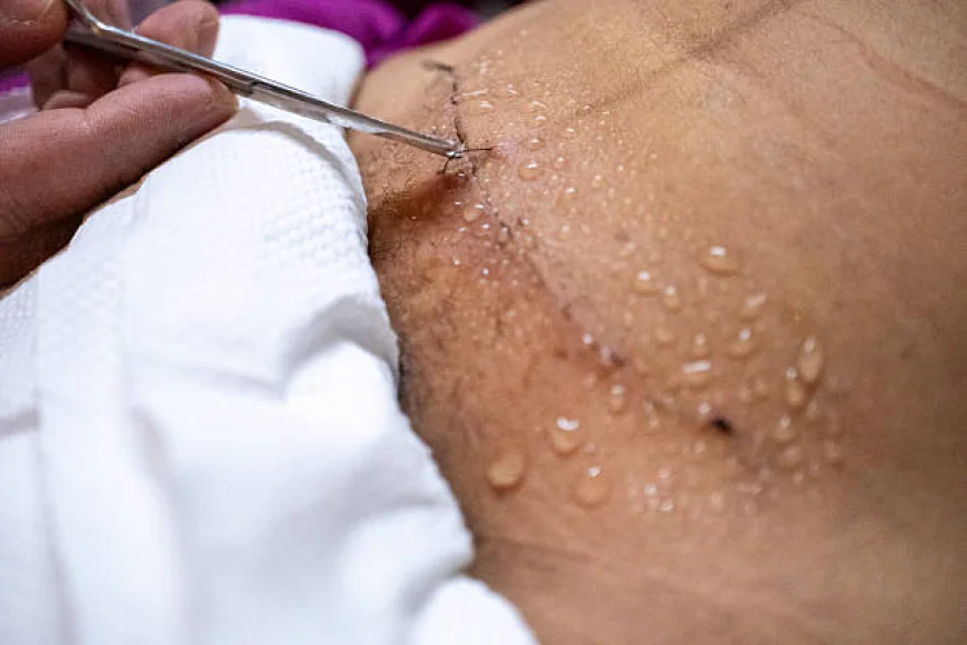 Does Skin lesion removal suit different types of skin lesions?