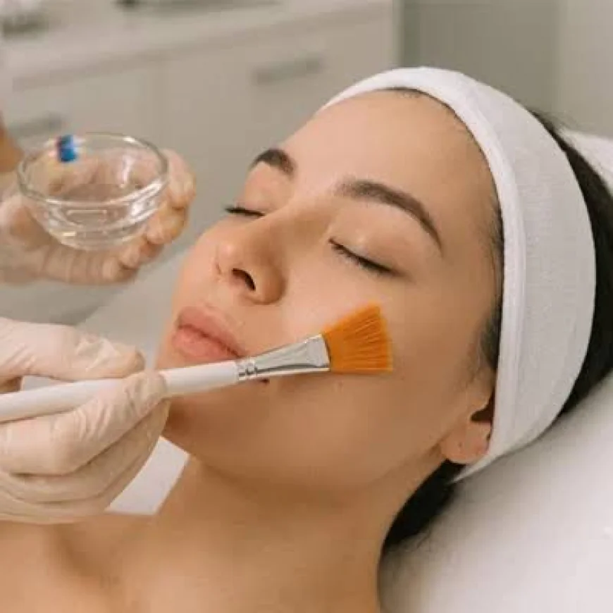 Can Glycolic Acid Peel Reduce Acne and Dark Spots Safely?
