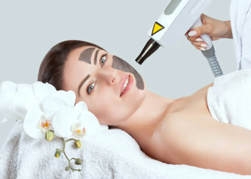 Does Laser Carbon Peel Improve Facial Skin Tone?