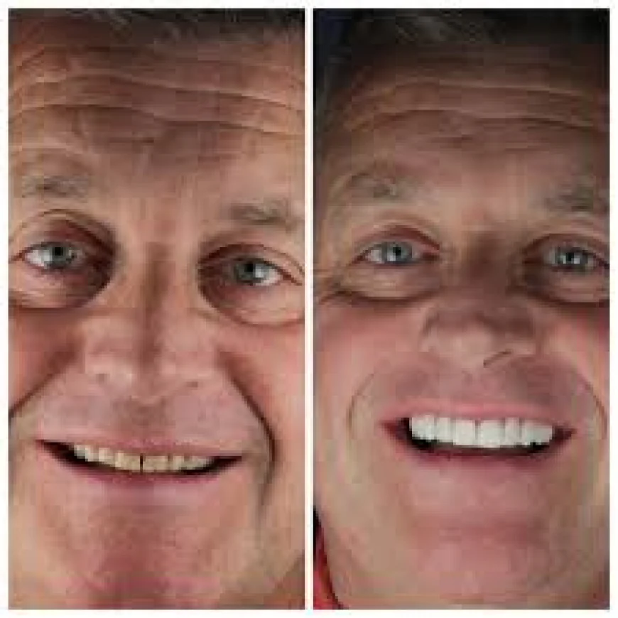 How Does Non-Surgical Jaw Correction Work for Bite and Jaw Alignment?
