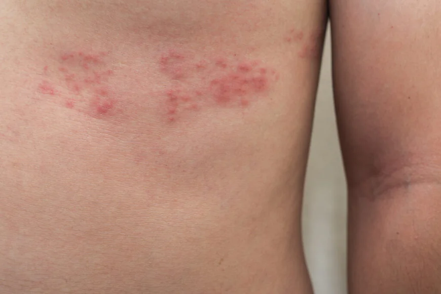 Does Skin Diseases Treatment Suit All Skin Types?