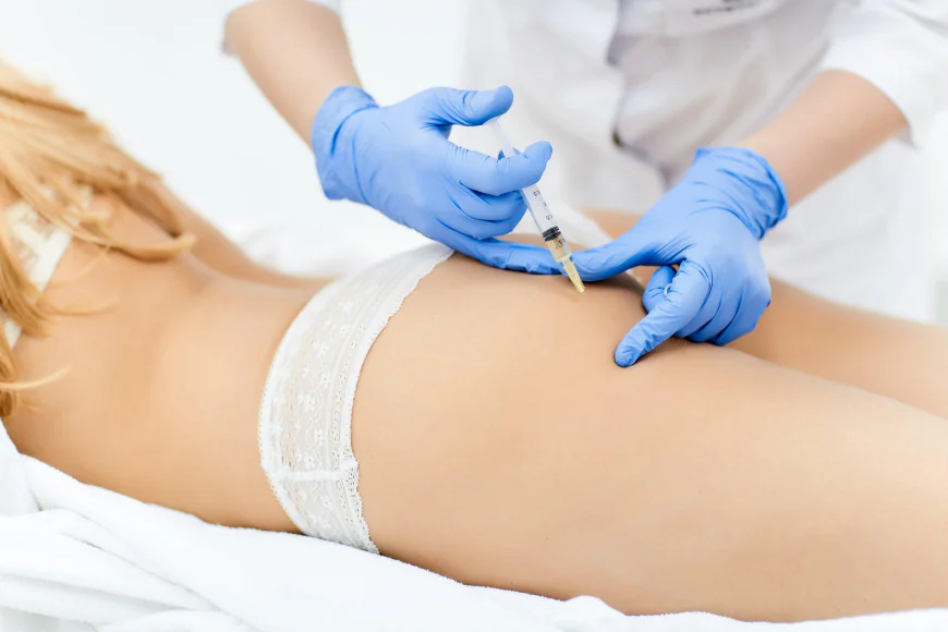 How Do Body Fillers Support a More Sculpted Body Appearance?
