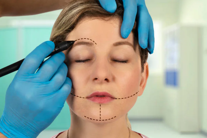 Can Facelifts improve a tired or aged appearance