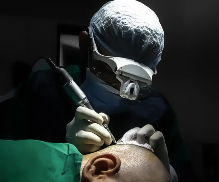 What Are Hair Transplant Side Effects? Everything You Need to Know Before Choosing the Best Hair Transplant in India