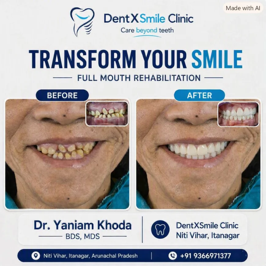 Looking for "Dental Implants Near Me"? Here's Everything You Need to Know Before You Choose
