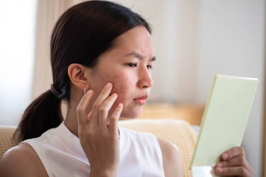 How can Acne treatment improve the overall look of skin?