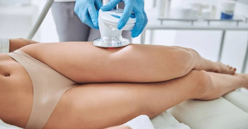 What Causes Cellulite and When Is Treatment Needed?