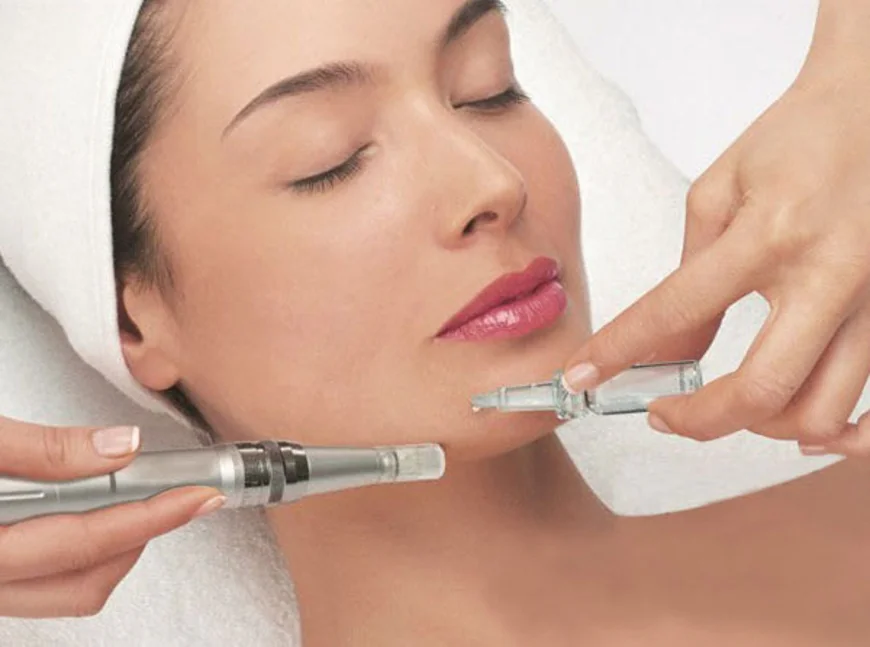 How Much Does Microneedling Improve Your Skin?