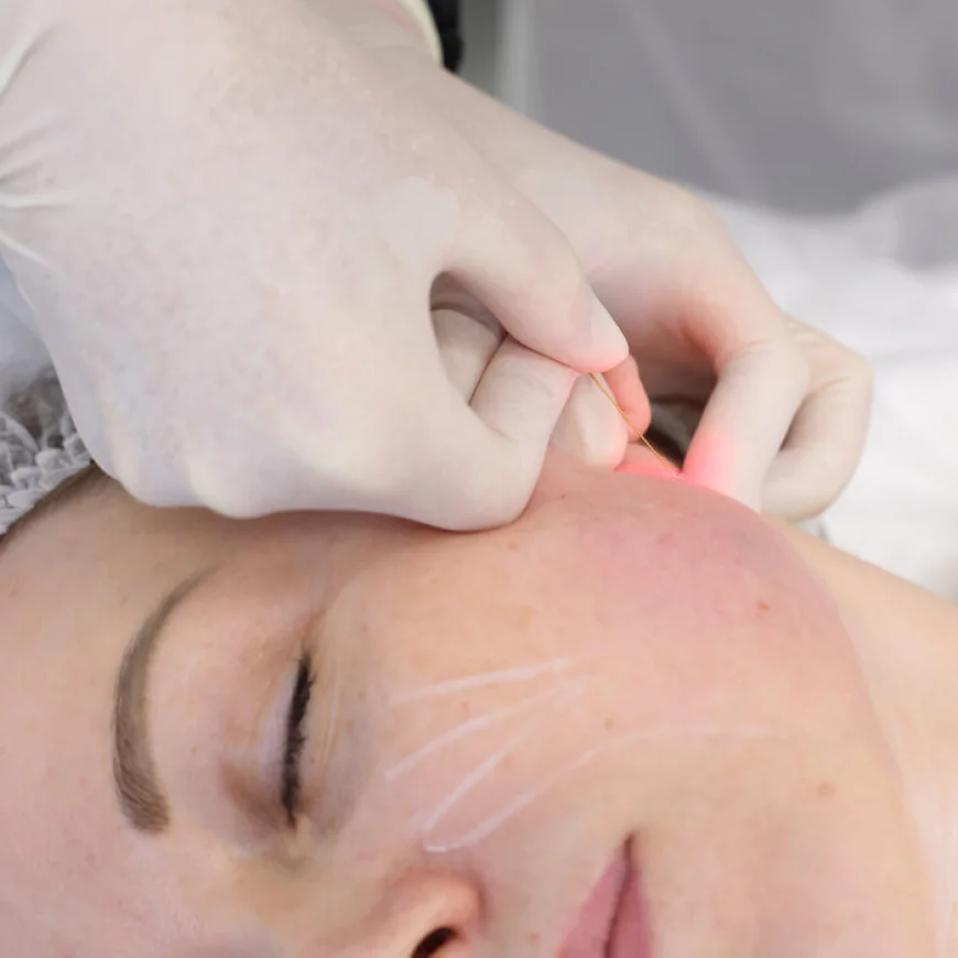 Does Endolift help improve facial contours naturally