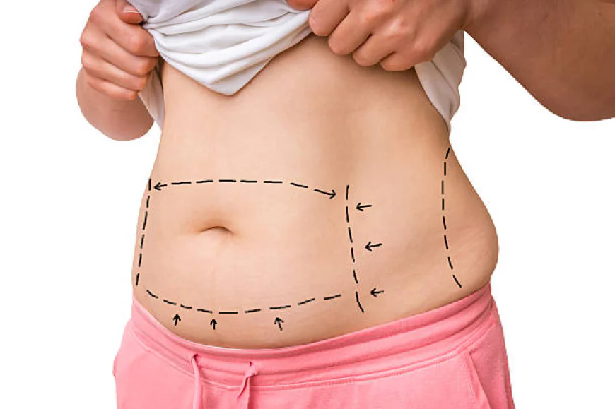 Is Lipo Abdominoplasty suitable for stable-weight adults