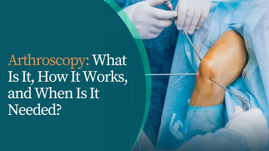 Arthroscopy: What Is It, How It Works, and When Is It Needed?