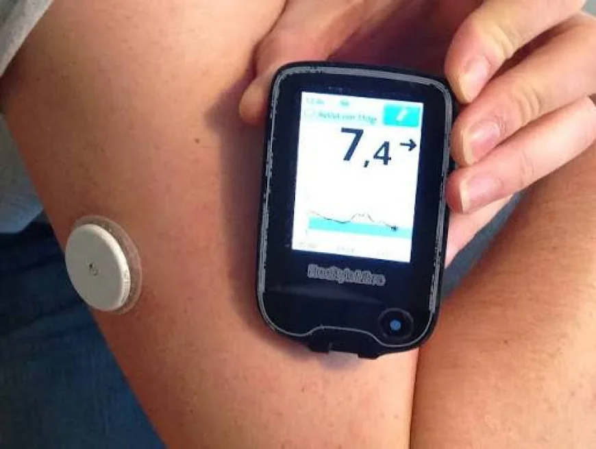 United States of America Continuous Glucose Monitoring Market Growth Dynamics 2026-2033