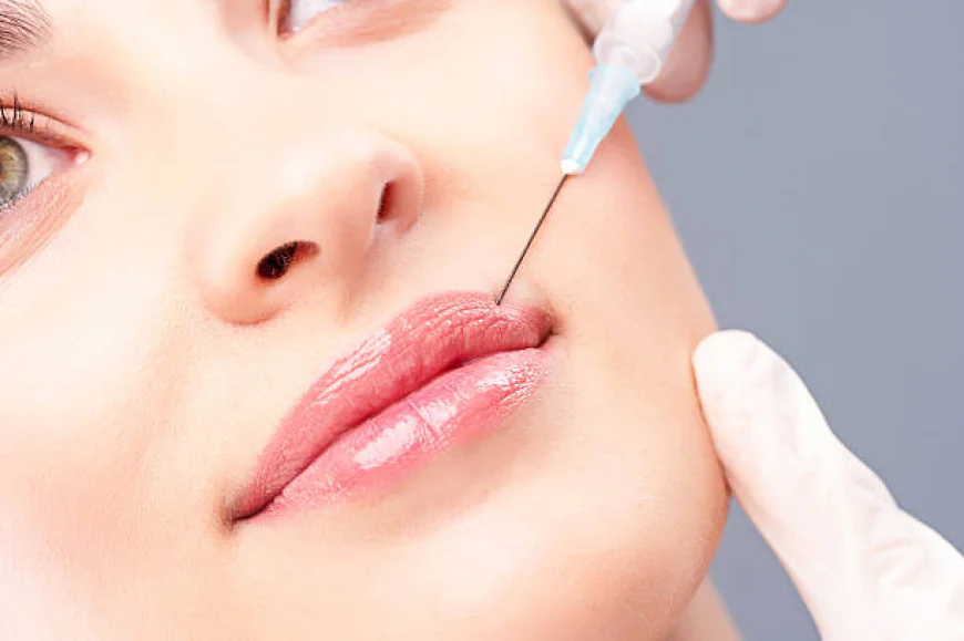 What Is the Ideal Lip Shape for Russian Lip Fillers ?