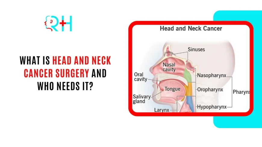What Is Head and Neck Cancer Surgery and Who Needs It?