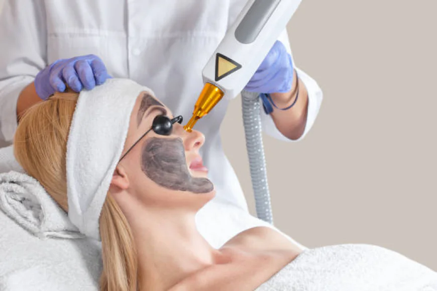 What are the skin benefits of Laser Carbon Peel treatment?