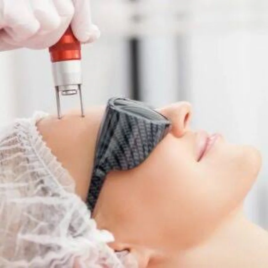 What makes Pico laser treatment different from other laser treatments?