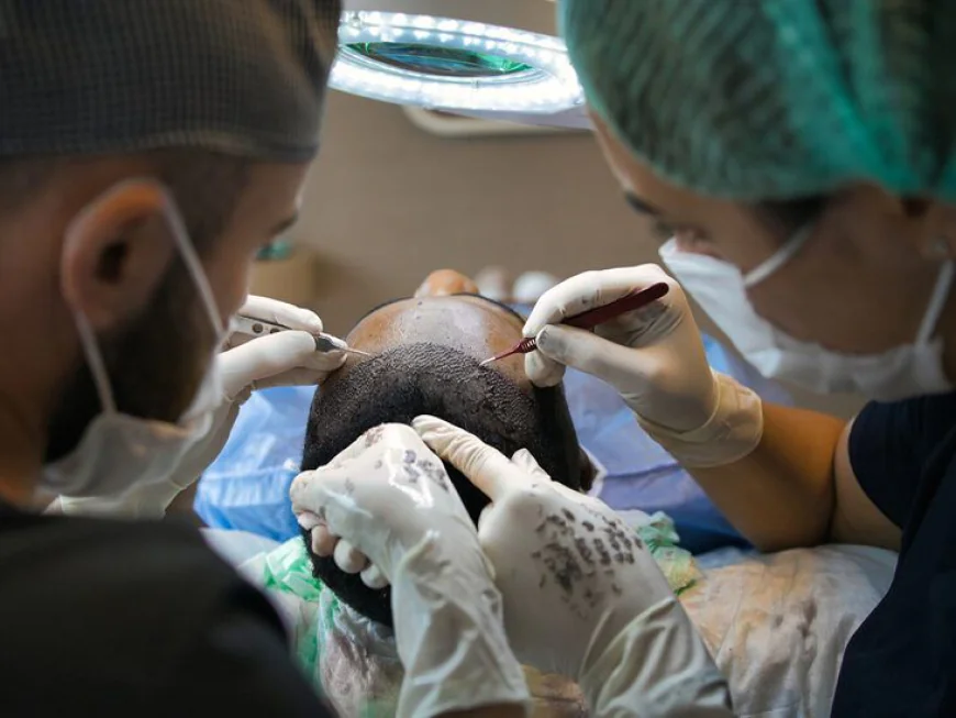Is DHI Direct Hair Implant Suitable for Men?