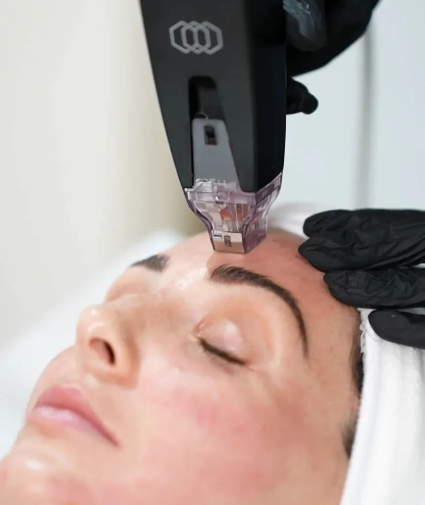 What Factors Affect Morpheus8 Treatment Results?