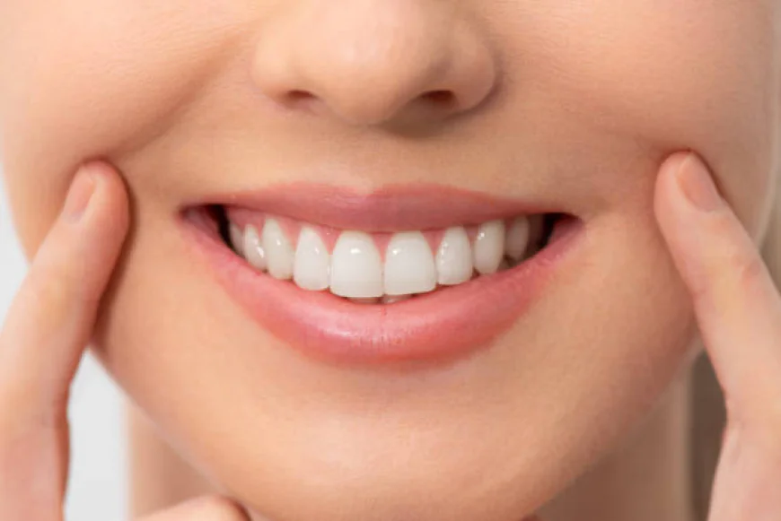 Is Teeth Whitening effective for stubborn food stains