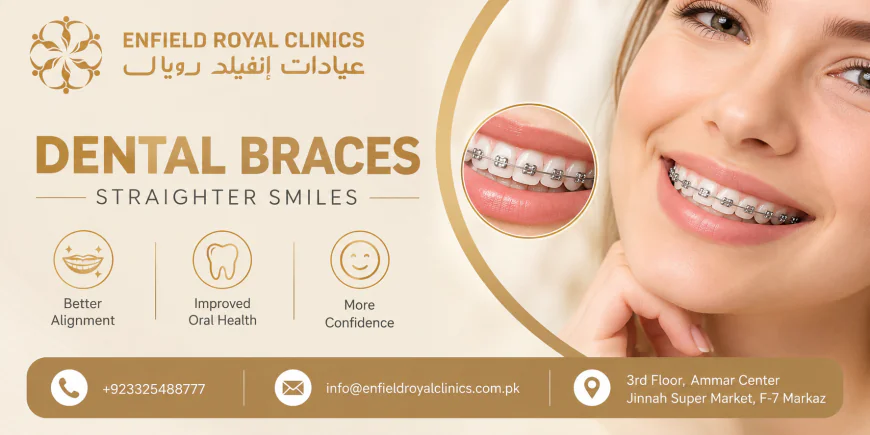 Who Is an Ideal Candidate for Dental Braces?