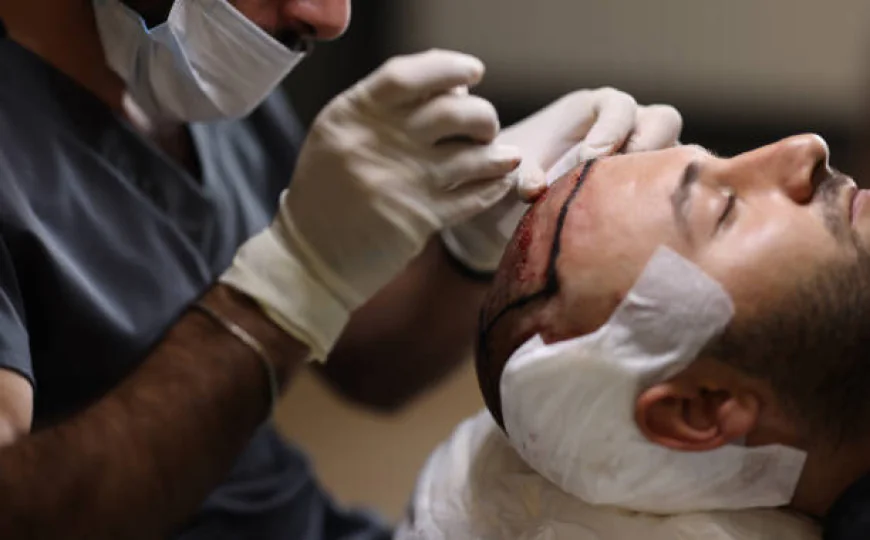 1 Dirham Hair Transplant in Dubai: Hairline Graft Planning