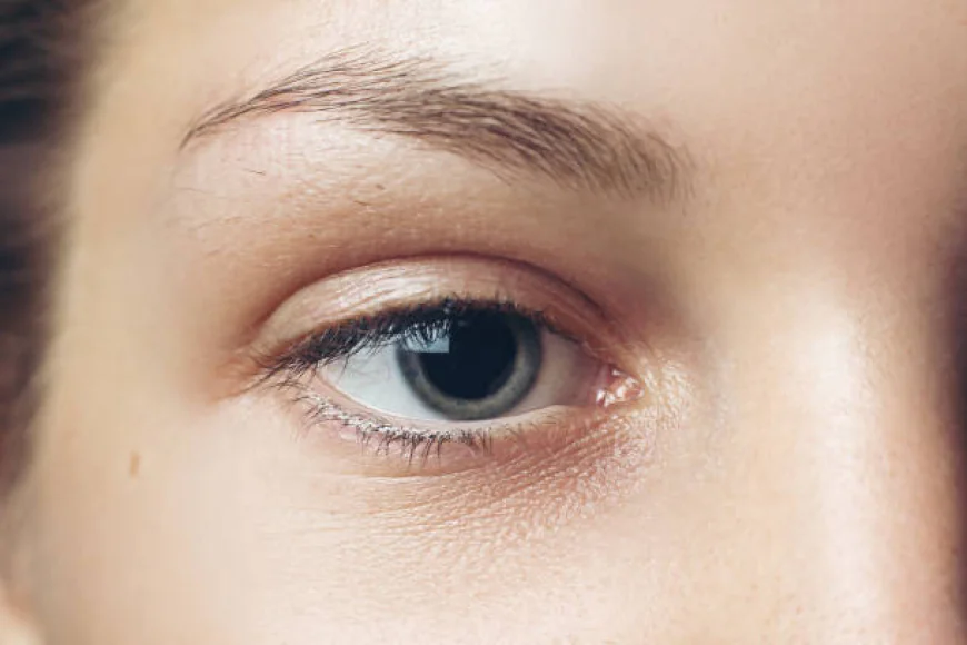 Is Eyelid Surgery Used for Puffy Lower Eyelids?