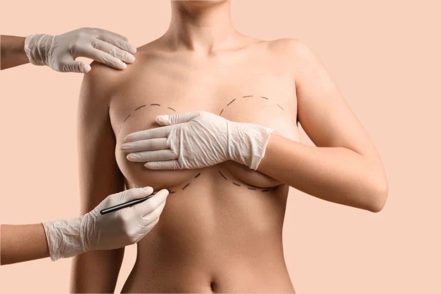 Does Breast Lift Surgery Remove Sagging Breast Skin?