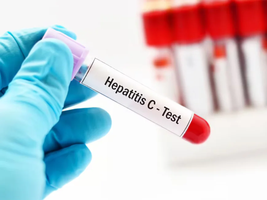 Common Reasons to Consider Hepatitis C Testing