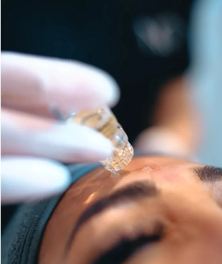Can an AquaGold Facial Enhance Skin Texture and Glow?