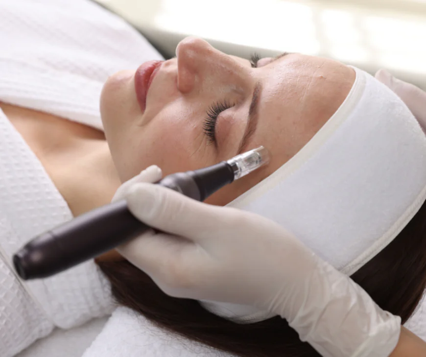 Does Microneedling Support Skin Elasticity and Smoothness?