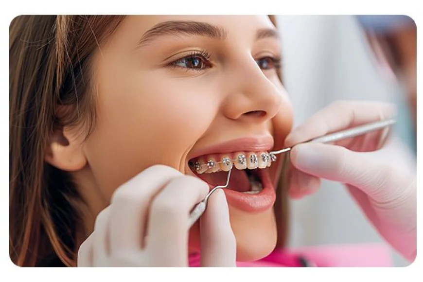 Braces in Dubai: A Complete Guide to Orthodontic Treatment