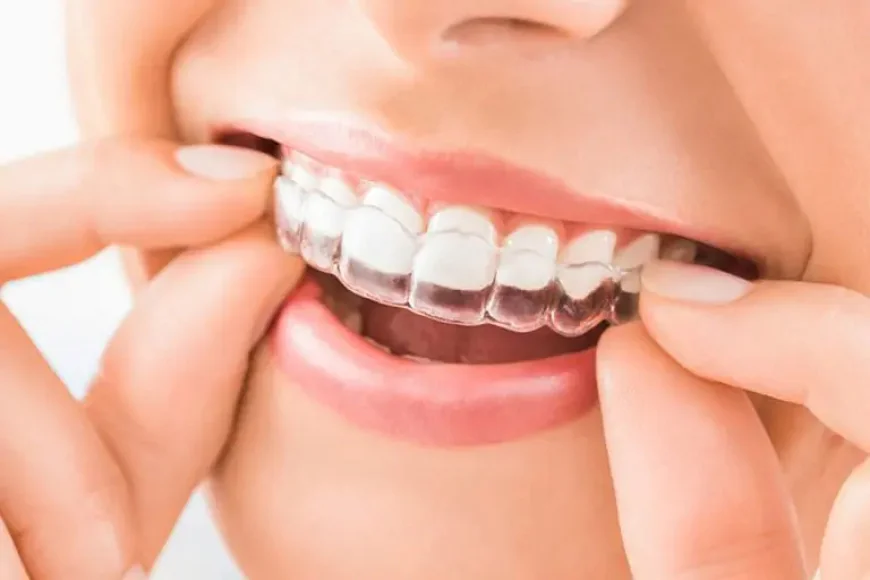 What Is Included in a Dental Implant Treatment?