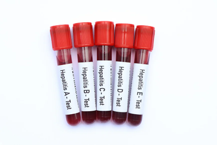 Common Reasons to Consider Hepatitis A Testing