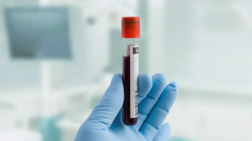 How Does a Cortisol Blood Test Work
