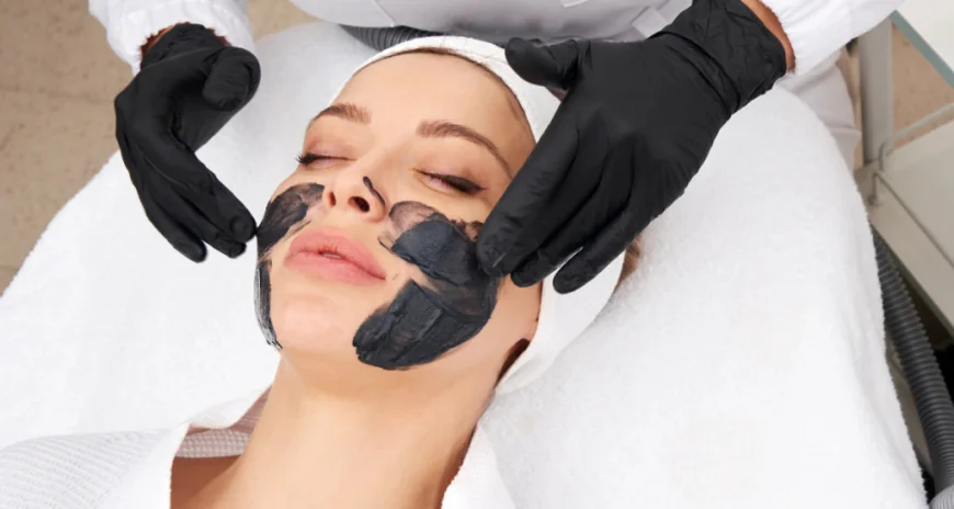 What Should You Know About Spectra Laser Carbon Peel?