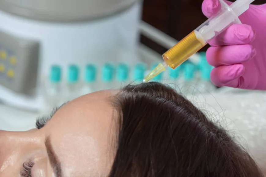 Can PRP Hair Treatment in Abu Dhabi Be Used After Hair Loss