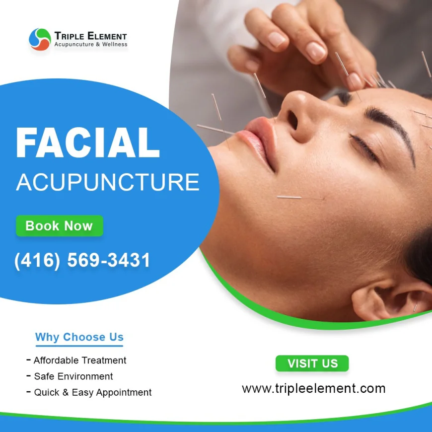 Can Facial Acupuncture Improve Your Skin Routine?