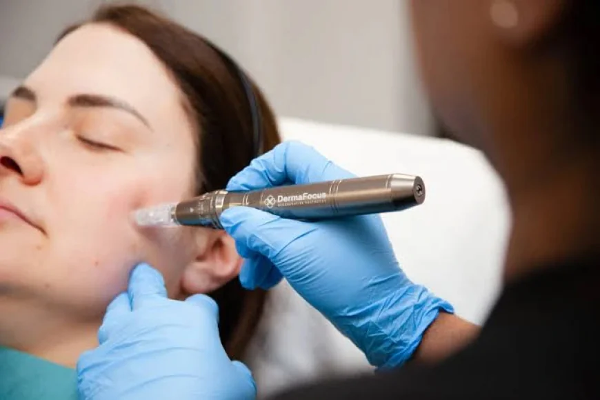 What Can Exosomes Therapy Do for Dull Skin?