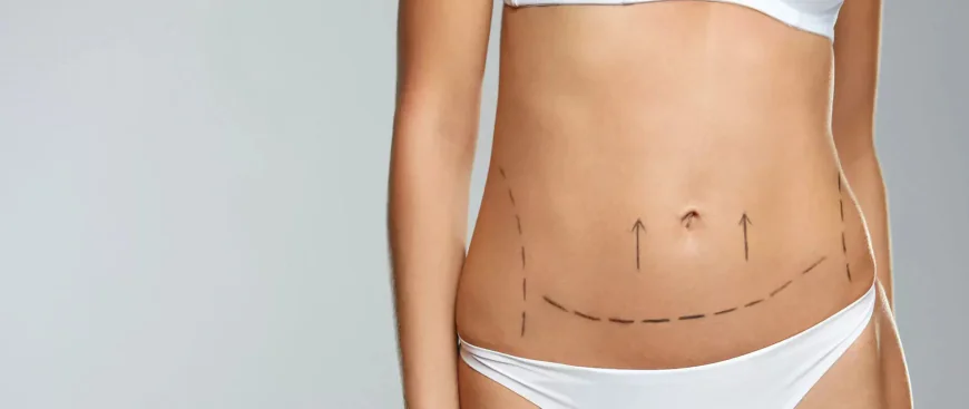Is Lipo Abdominoplasty Suitable After Weight Loss?