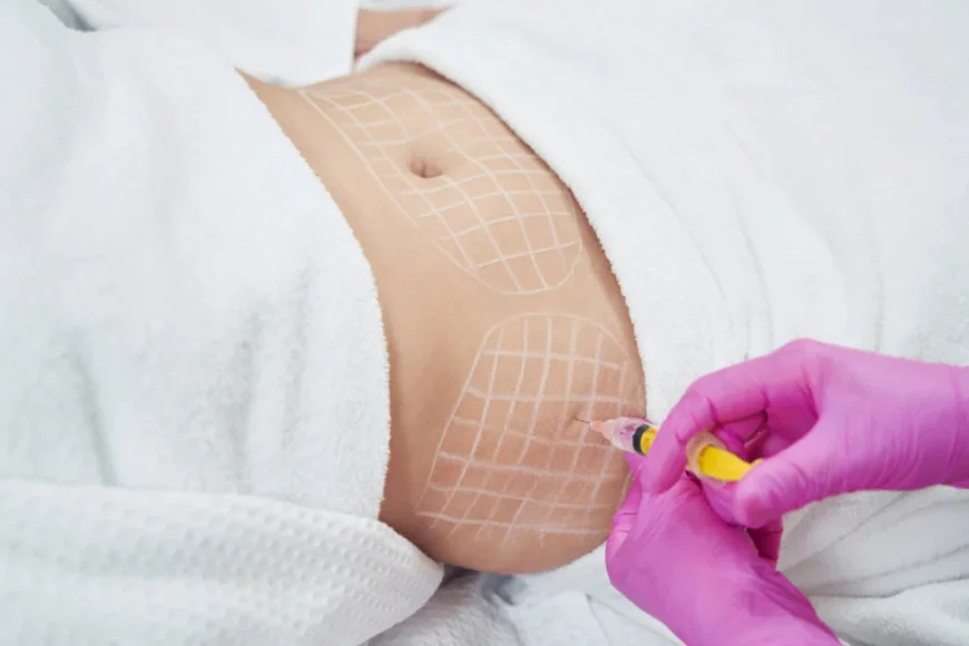 Is Fat Melting Injections a Non-Surgical Option?