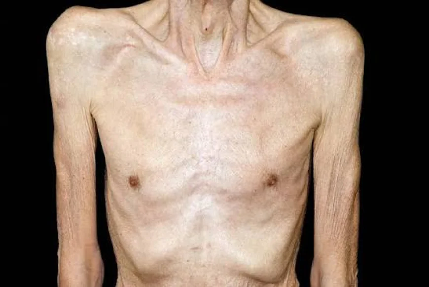 Cancer Cachexia Market Size, Trends, and Growth Forecast 2026-2033
