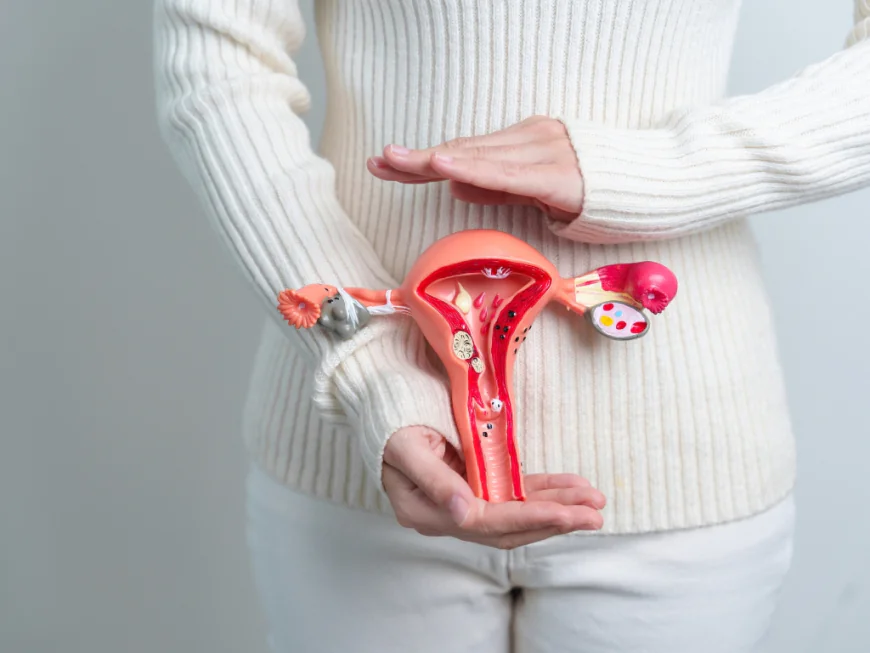 Can Fibroid Embolization Help Relieve Common Fibroid Symptoms?