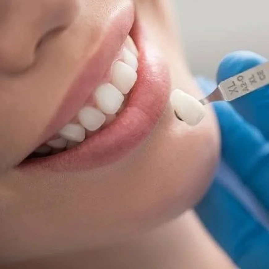 Ceramic Crown Dubai & Abu Dhabi for Improved Smile Confidence | Glamorous Clinic Dubai