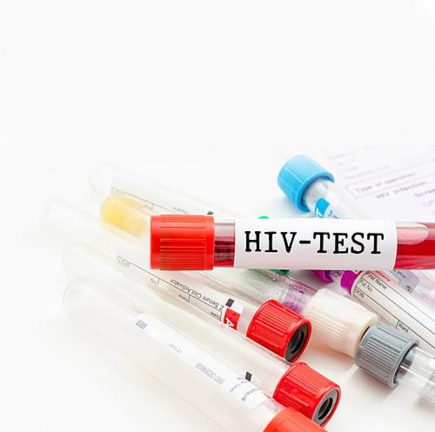 HIV Test in Dubai: Types and Testing Methods
