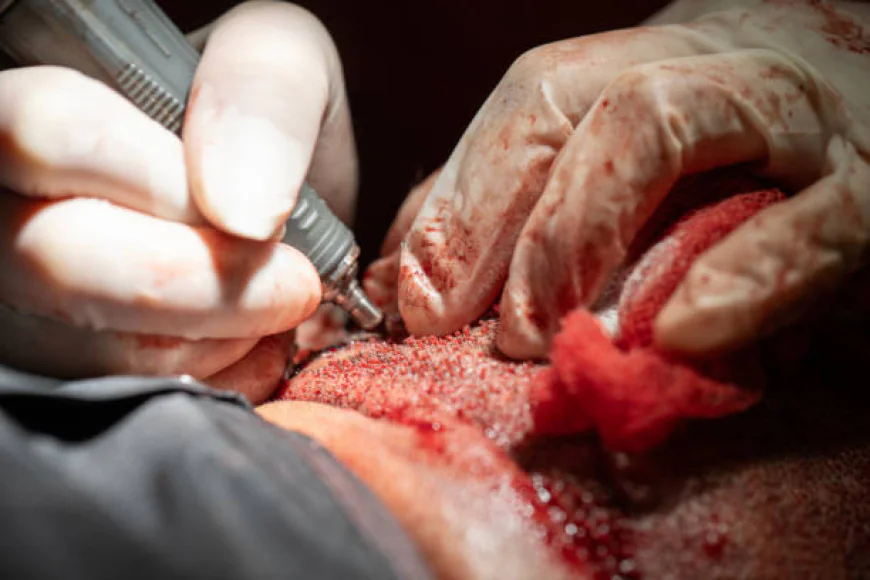 Is FUSS Hair Transplant in Dubai Suitable for Older Adults