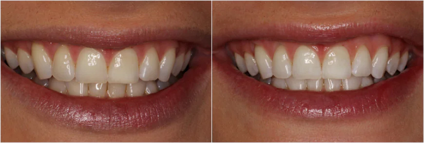 Why Preventive Dentistry Is Key to Affordable Family Dental Care